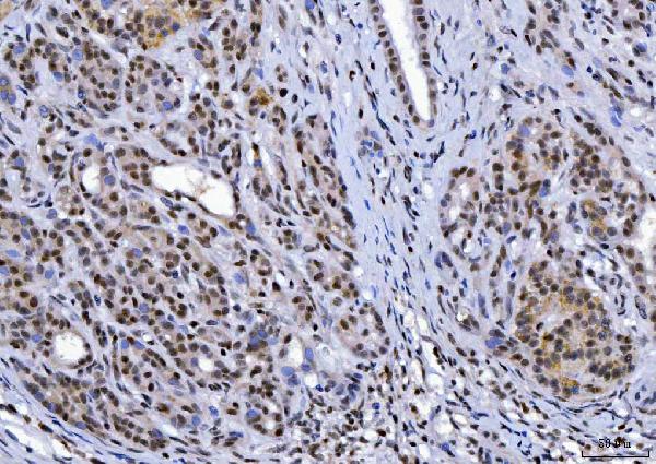 2 - Anti-YY1 Antibody Picoband™ (monoclonal, 2C10F9) ABO16239