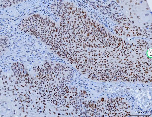 2 - Anti-YY1 Antibody Picoband™ (monoclonal, 2C10F9) ABO16239