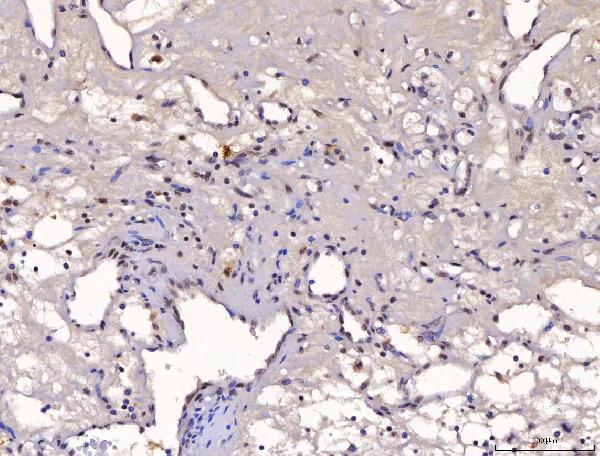 2 - Anti-YY1 Antibody Picoband™ (monoclonal, 2C10F9) ABO16239