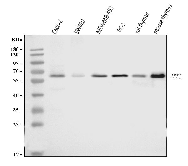 1 - Anti-YY1 Antibody Picoband™ (monoclonal, 2C10F9) ABO16239