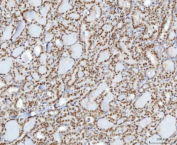 2 - Anti-YY1 Antibody Picoband™ (monoclonal, 3F3E7) ABO16240