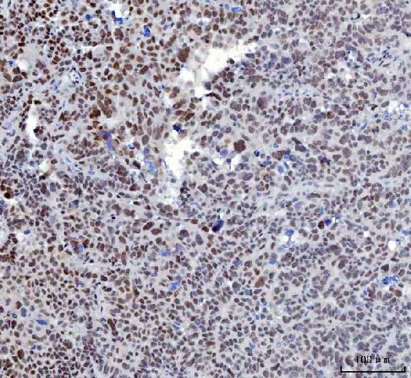 2 - Anti-YY1 Antibody Picoband™ (monoclonal, 3F3E7) ABO16240