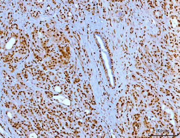 2 - Anti-YY1 Antibody Picoband™ (monoclonal, 3F3E7) ABO16240