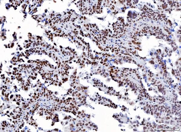 2 - Anti-YY1 Antibody Picoband™ (monoclonal, 3F3E7) ABO16240