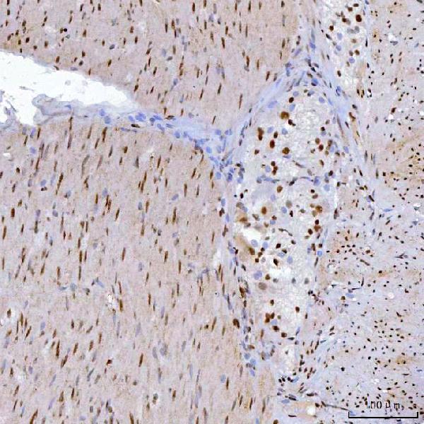 2 - Anti-YY1 Antibody Picoband™ (monoclonal, 3F3E7) ABO16240