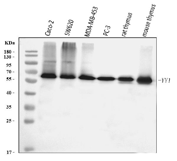 1 - Anti-YY1 Antibody Picoband™ (monoclonal, 3F3E7) ABO16240