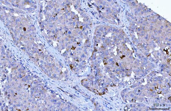 2 - Anti-HGS Antibody Picoband™ (monoclonal, 6C2E1) ABO16241