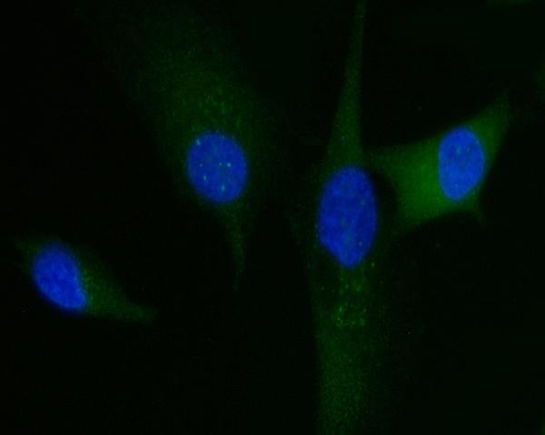 3 - Anti-HGS Antibody Picoband™ (monoclonal, 4B7E2) ABO16242