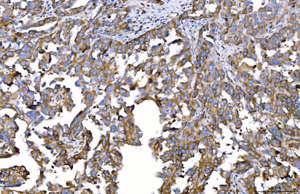 2 - Anti-HGS Antibody Picoband™ (monoclonal, 4B7E2) ABO16242
