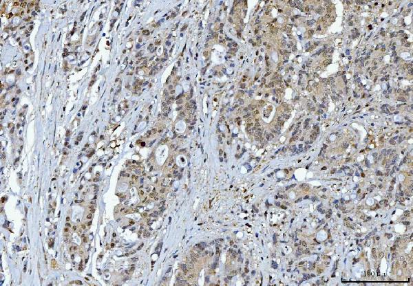 2 - Anti-YWHAE Antibody Picoband™ (monoclonal, 3G11G2) ABO16243