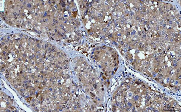 2 - Anti-YWHAE Antibody Picoband™ (monoclonal, 3G11G2) ABO16243