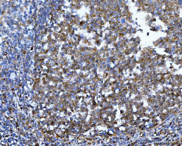 2 - Anti-YWHAE Antibody Picoband™ (monoclonal, 3G11G2) ABO16243
