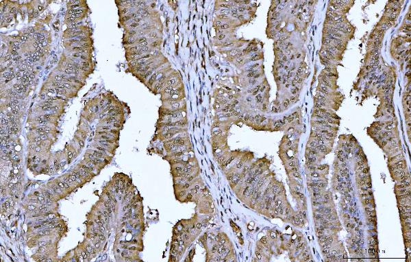 2 - Anti-YWHAE Antibody Picoband™ (monoclonal, 3G11G2) ABO16243