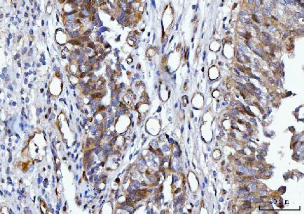 2 - Anti-YWHAE Antibody Picoband™ (monoclonal, 3G11G2) ABO16243