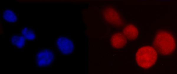 3 - Anti-PCBP2/hnRNP E2 Antibody Picoband™ (monoclonal, 4B9C7) ABO16244