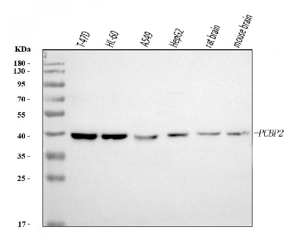 1 - Anti-PCBP2/hnRNP E2 Antibody Picoband™ (monoclonal, 4B9C7) ABO16244
