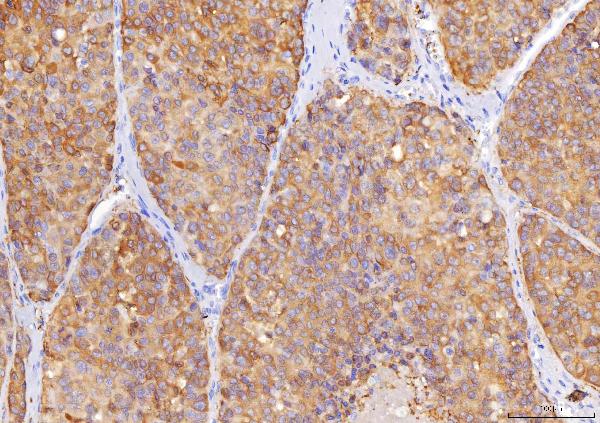 2 - Anti-Sorbitol Dehydrogenase/SORD Antibody Picoband™ (monoclonal, 12B10G2) ABO16245