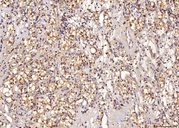 2 - Anti-Sorbitol Dehydrogenase/SORD Antibody Picoband™ (monoclonal, 12B10G2) ABO16245