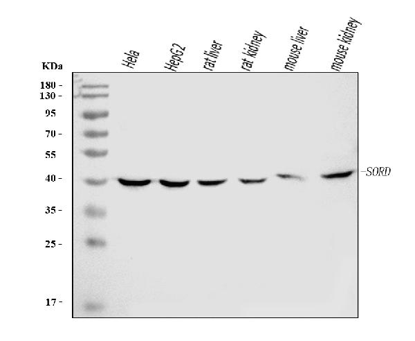1 - Anti-Sorbitol Dehydrogenase/SORD Antibody Picoband™ (monoclonal, 12B10G2) ABO16245