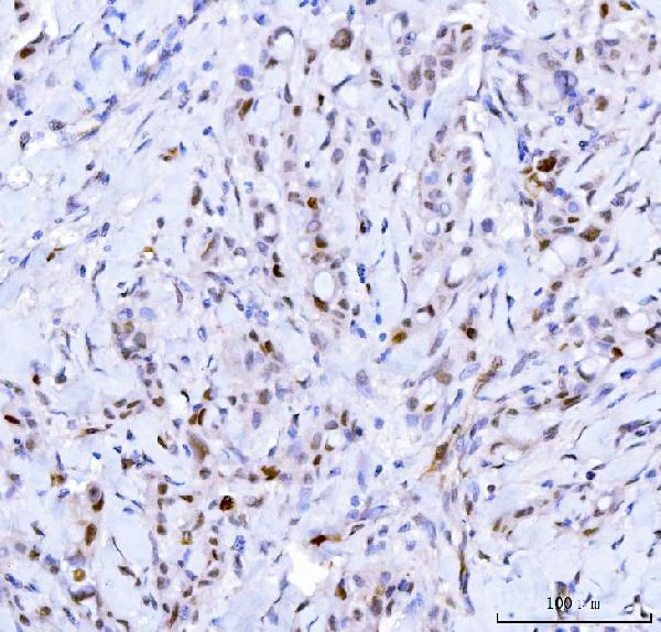 2 - Anti-Cdk2 Antibody Picoband™ (monoclonal, 5B12D1) ABO16246