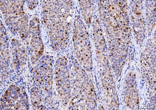 2 - Anti-Cdk2 Antibody Picoband™ (monoclonal, 5B12D1) ABO16246
