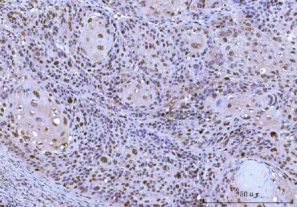 2 - Anti-Cdk2 Antibody Picoband™ (monoclonal, 6D5B5) ABO16247