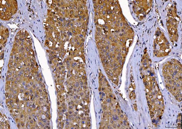 2 - Anti-Cdk2 Antibody Picoband™ (monoclonal, 6D5B5) ABO16247