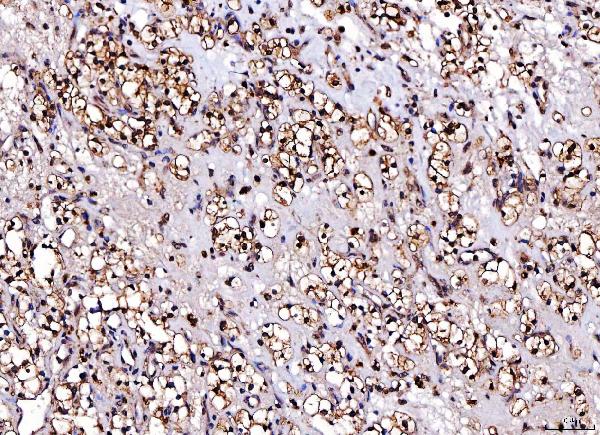 2 - Anti-Cdk2 Antibody Picoband™ (monoclonal, 6D5B5) ABO16247