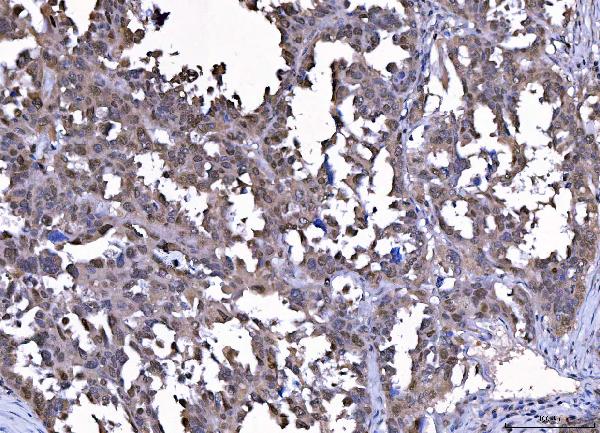 2 - Anti-Cdk2 Antibody Picoband™ (monoclonal, 6D5B5) ABO16247