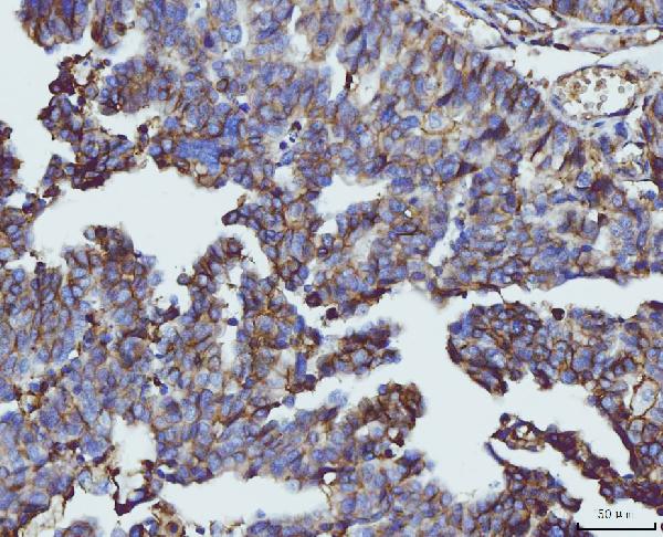 2 - Anti-CD147/Emmprin Antibody Picoband™ (monoclonal, 3B13G7) ABO16250