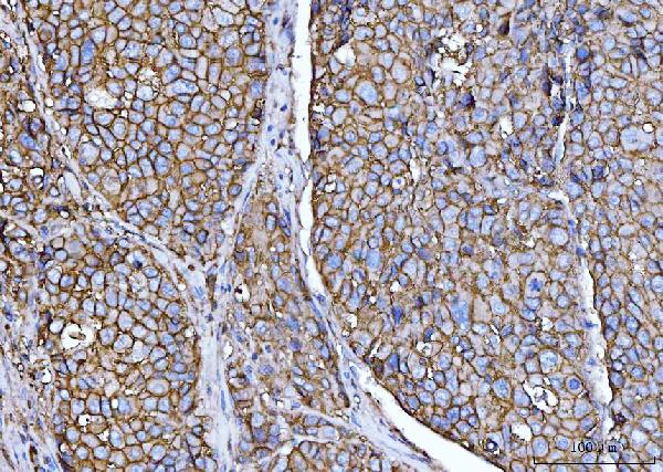 2 - Anti-CD147/Emmprin Antibody Picoband™ (monoclonal, 3B13G7) ABO16250