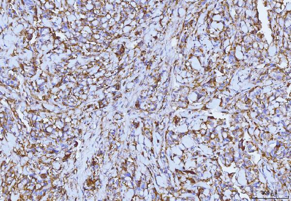 2 - Anti-CD147/Emmprin Antibody Picoband™ (monoclonal, 3B13G7) ABO16250