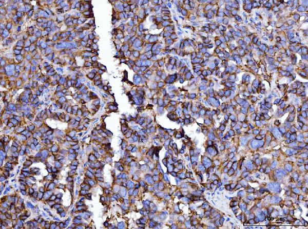 2 - Anti-CD147/Emmprin Antibody Picoband™ (monoclonal, 3B13G7) ABO16250