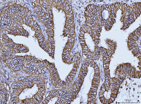 2 - Anti-CD147/Emmprin Antibody Picoband™ (monoclonal, 3B13G7) ABO16250
