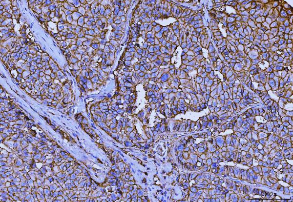 2 - Anti-CD147/Emmprin Antibody Picoband™ (monoclonal, 7H5E7) ABO16251