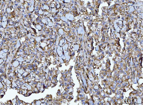 2 - Anti-CD147/Emmprin Antibody Picoband™ (monoclonal, 7H5E7) ABO16251