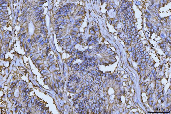 2 - Anti-CD147/Emmprin Antibody Picoband™ (monoclonal, 7H5E7) ABO16251