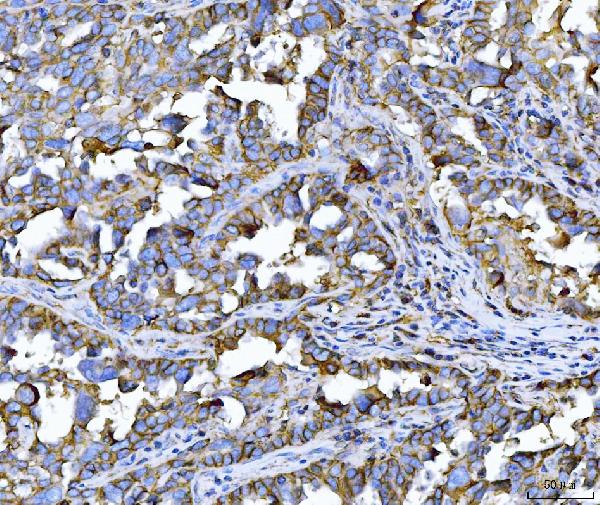 2 - Anti-CD147/Emmprin Antibody Picoband™ (monoclonal, 7H5E7) ABO16251