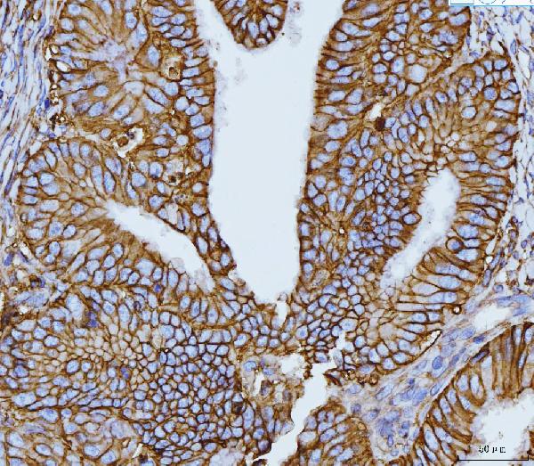 2 - Anti-CD147/Emmprin Antibody Picoband™ (monoclonal, 7H5E7) ABO16251