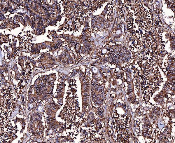2 - Anti-CD147/Emmprin Antibody Picoband™ (monoclonal, 6H2B2) ABO16252