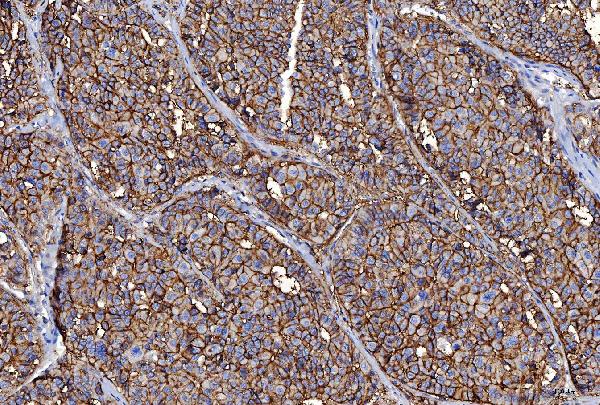 2 - Anti-CD147/Emmprin Antibody Picoband™ (monoclonal, 6H2B2) ABO16252