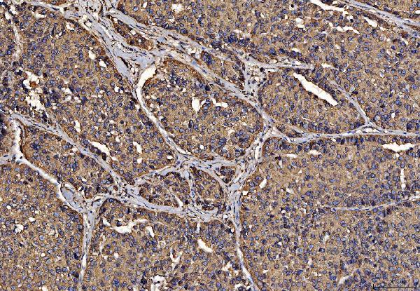 2 - Anti-PDIA6 Antibody Picoband™ (monoclonal, 3H5E7) ABO16253
