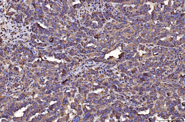 2 - Anti-PDIA6 Antibody Picoband™ (monoclonal, 3H5E7) ABO16253