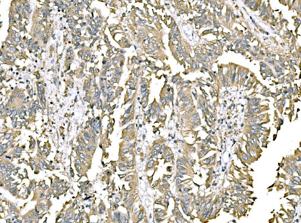 2 - Anti-ERp57 Antibody Picoband™ (monoclonal, 7E5) ABO16254