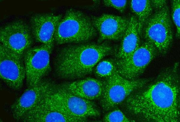 3 - Anti-Beclin 1 Antibody Picoband™ (monoclonal, 2D12A3) ABO16255