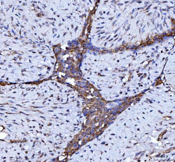 2 - Anti-Beclin 1 Antibody Picoband™ (monoclonal, 2D12A3) ABO16255