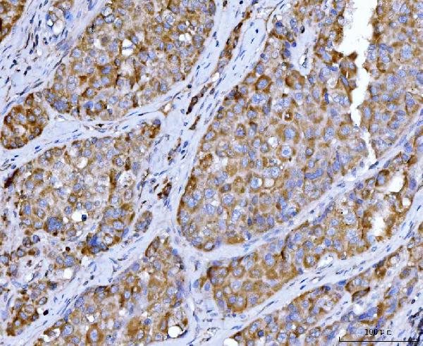 2 - Anti-Beclin 1 Antibody Picoband™ (monoclonal, 2D12A3) ABO16255
