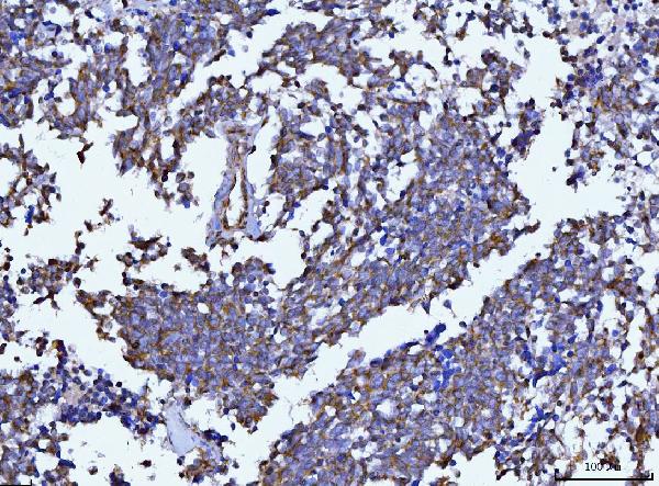 2 - Anti-Beclin 1 Antibody Picoband™ (monoclonal, 2D12A3) ABO16255