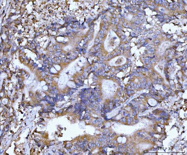 2 - Anti-Beclin 1 Antibody Picoband™ (monoclonal, 2D12A3) ABO16255