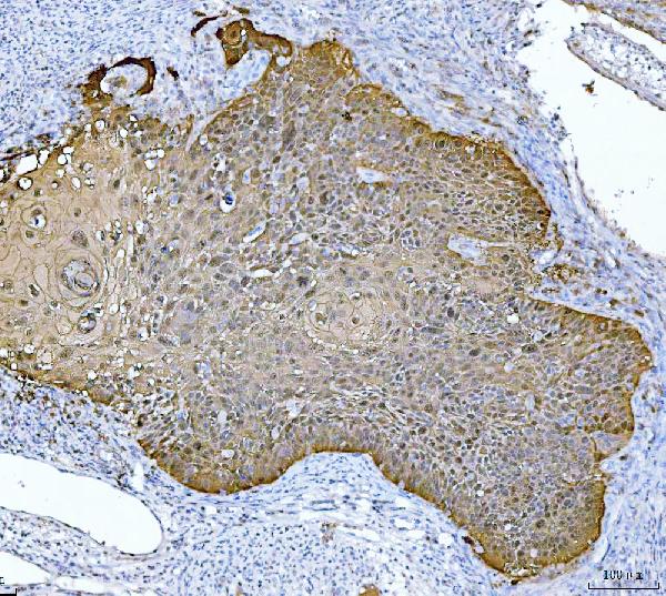 2 - Anti-MASPIN Antibody Picoband™ (monoclonal, 7G4E1) ABO16256